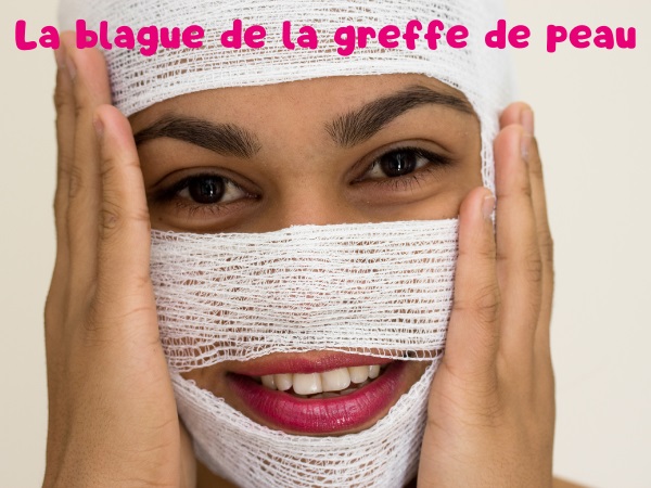 blague accident de voiture, blague greffe de peau, blague cul, blague bises, blague postérieur, blague joue, humour drôle